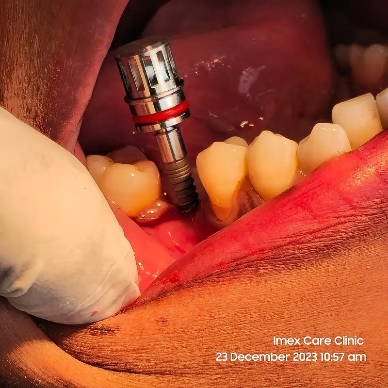 Imex Care Clinic (Imprssns n Exprssns)