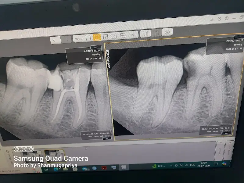 Root Care Dental Clinic - Dental Clinic in Bengaluru